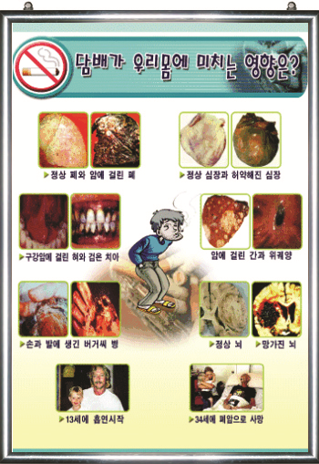 스쿨프린트/행사패널/금연의날/흡연예방교육/청소년흡연[흡연예방교육패널]담배가 우리몸에 미치는 영향은 액자 : 스쿨프린트