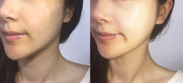 New Anti Aging Celavic nucleic acid anti-aging cre