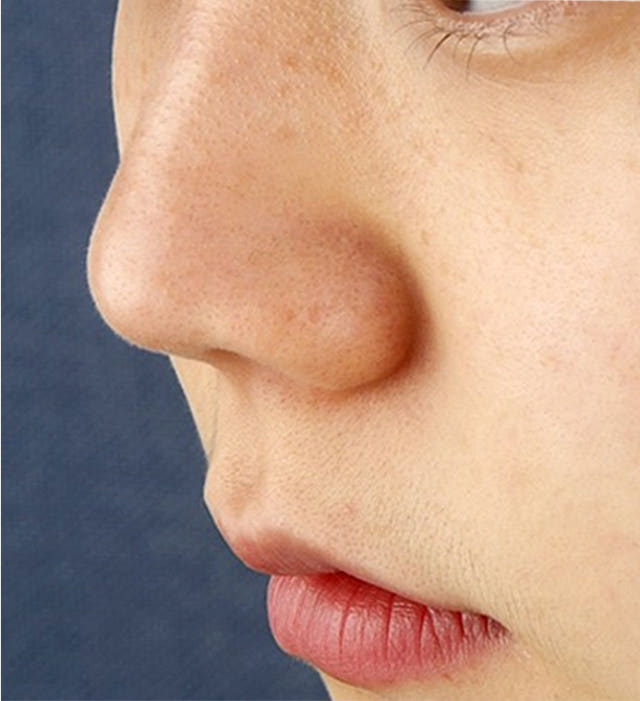 New Merfolp Foraging Serum 30ml Pore Reduction Bla