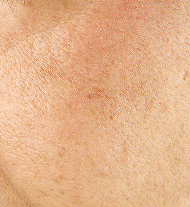 New Merfolp Foraging Serum 30ml Pore Reduction Bla