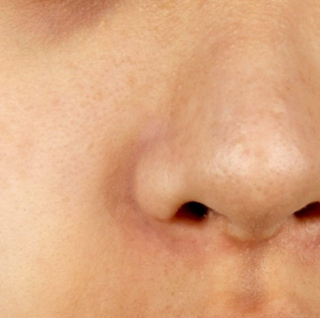 New Merfolp Foraging Serum 30ml Pore Reduction Bla