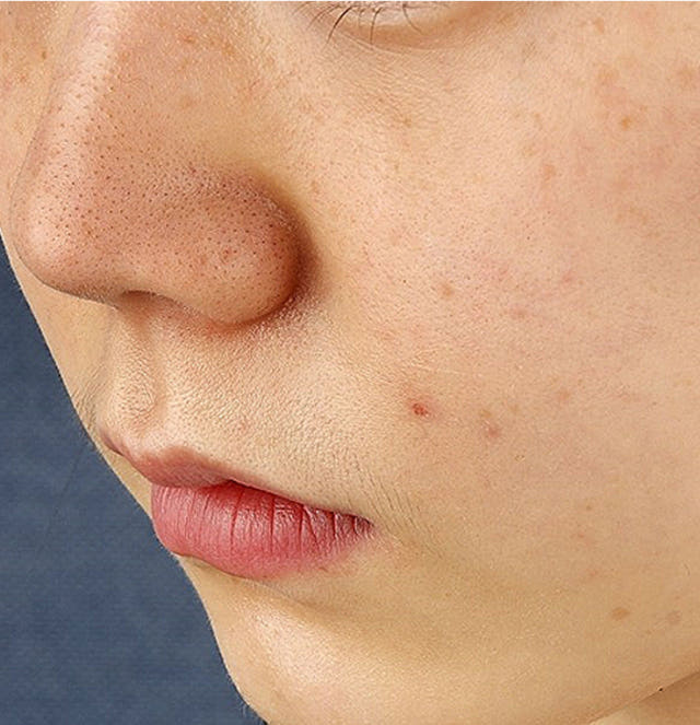 New Merfolp Foraging Serum 30ml Pore Reduction Bla