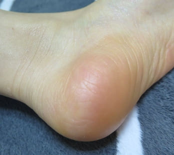 Cosmetics Lavender Therapy Oil 200ml + Mask Pack 1 piece How to get rid of stretch marks Dr. Olga A24