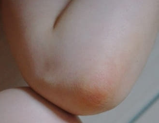 Cosmetics Lavender Therapy Oil 200ml + Mask Pack 1 piece How to get rid of stretch marks Dr. Olga A24