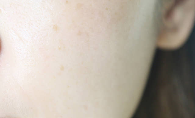 New EX-C Regeneration Cream Vitamin U Sensitive Re