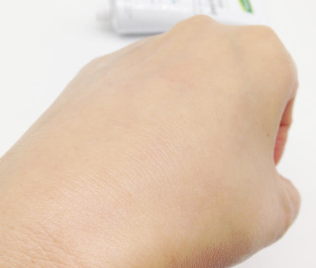 New Mentholatum ACNESS Derma Relief Recovery Cream