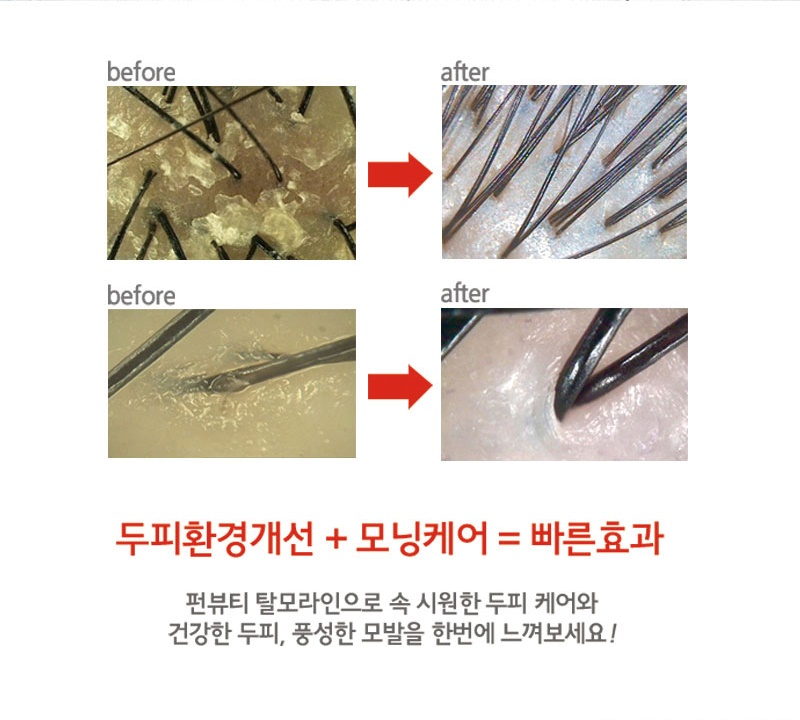 스포츠 헤어 샴푸 추천 두피 케어 순위 500ml 포도향 식약처 허가 인증 남성 : 까꿍몰