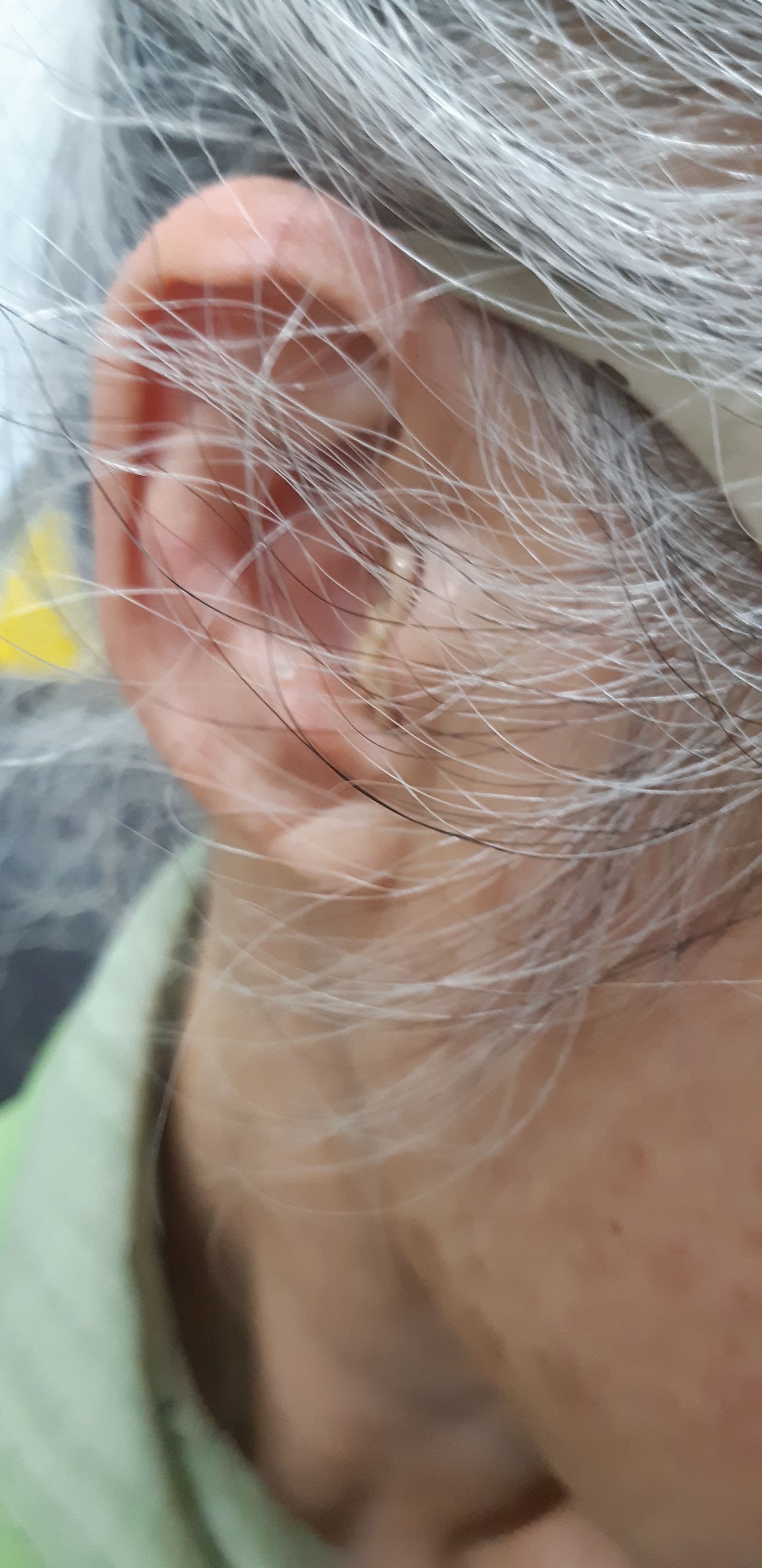 보청기센터 원장이 개발한 울림없는A3음성증폭기/ 보청기배터리, 습기제 ,소음방지귀마개, 쇼핑백 제공 : 주식회사 맑음히어링테크