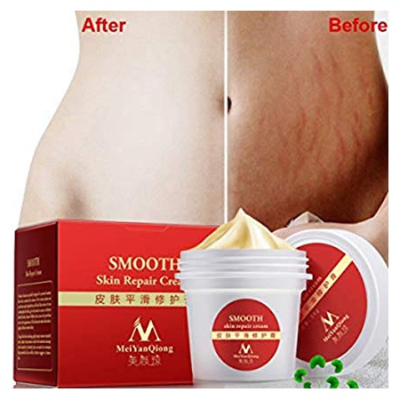 GSTONE High Quality Smooth Postpartum Cream For Stretch Marks Scar Removal To Maternity Skin Repair : ____ - _____