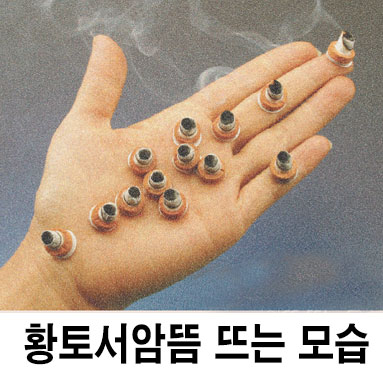 서암뜸 쑥뜸 덕용 뜸 2000개입 : 고려수지침쇼핑몰
