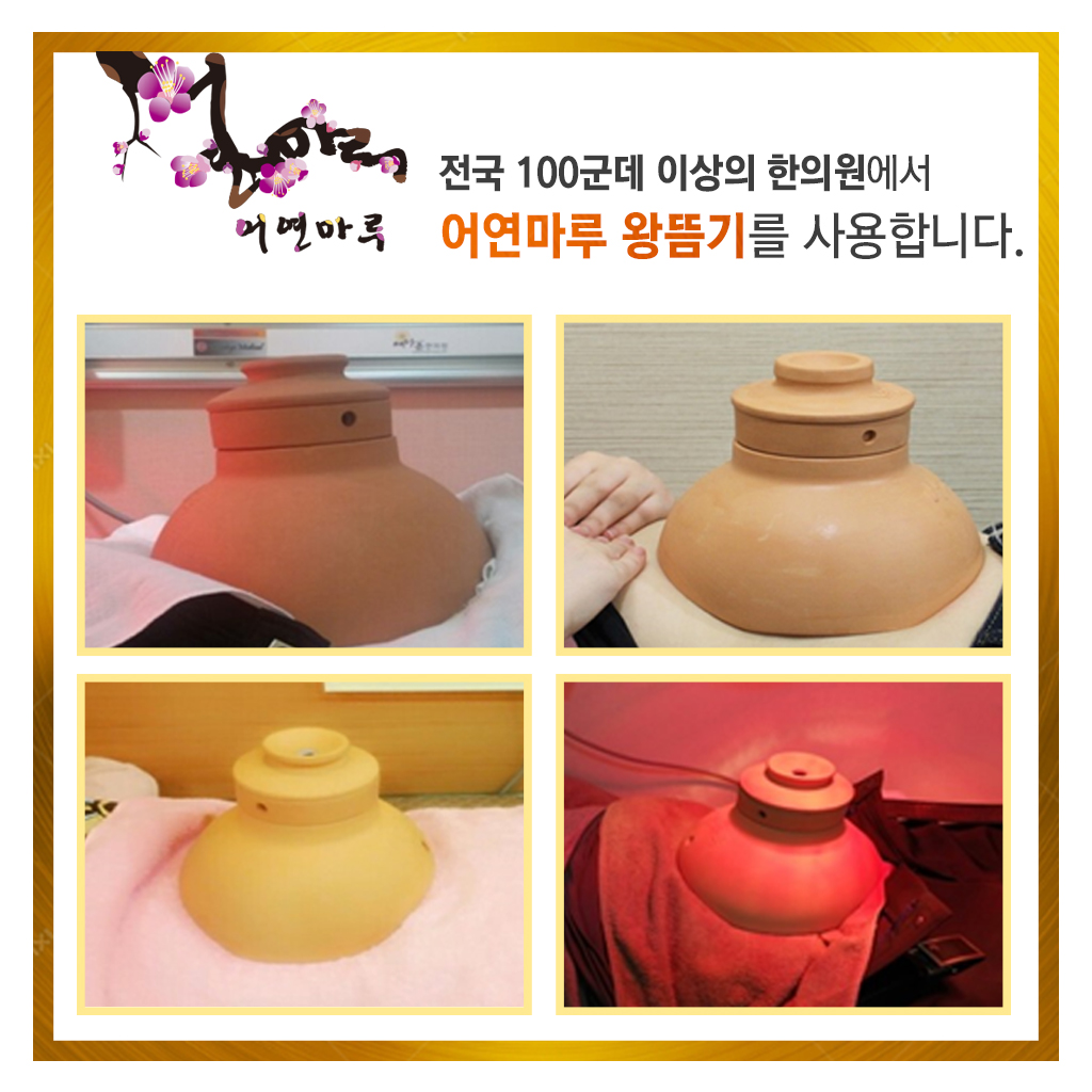 어연마루 쑥뜸기 왕뜸기 쑥뜸기구 무연쑥뜸 왕뜸 : 어연마루