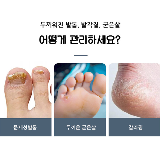 네일 케어 전동 드릴 세트 비트 손톱 발톱 큐티클제거 샤퍼 : 밀리언 아이템즈