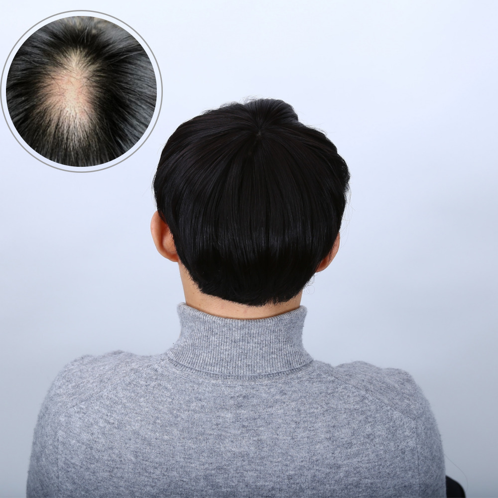 남자 남성 붙임 머리 정수리 부분 가발 : 원 인터내셔날