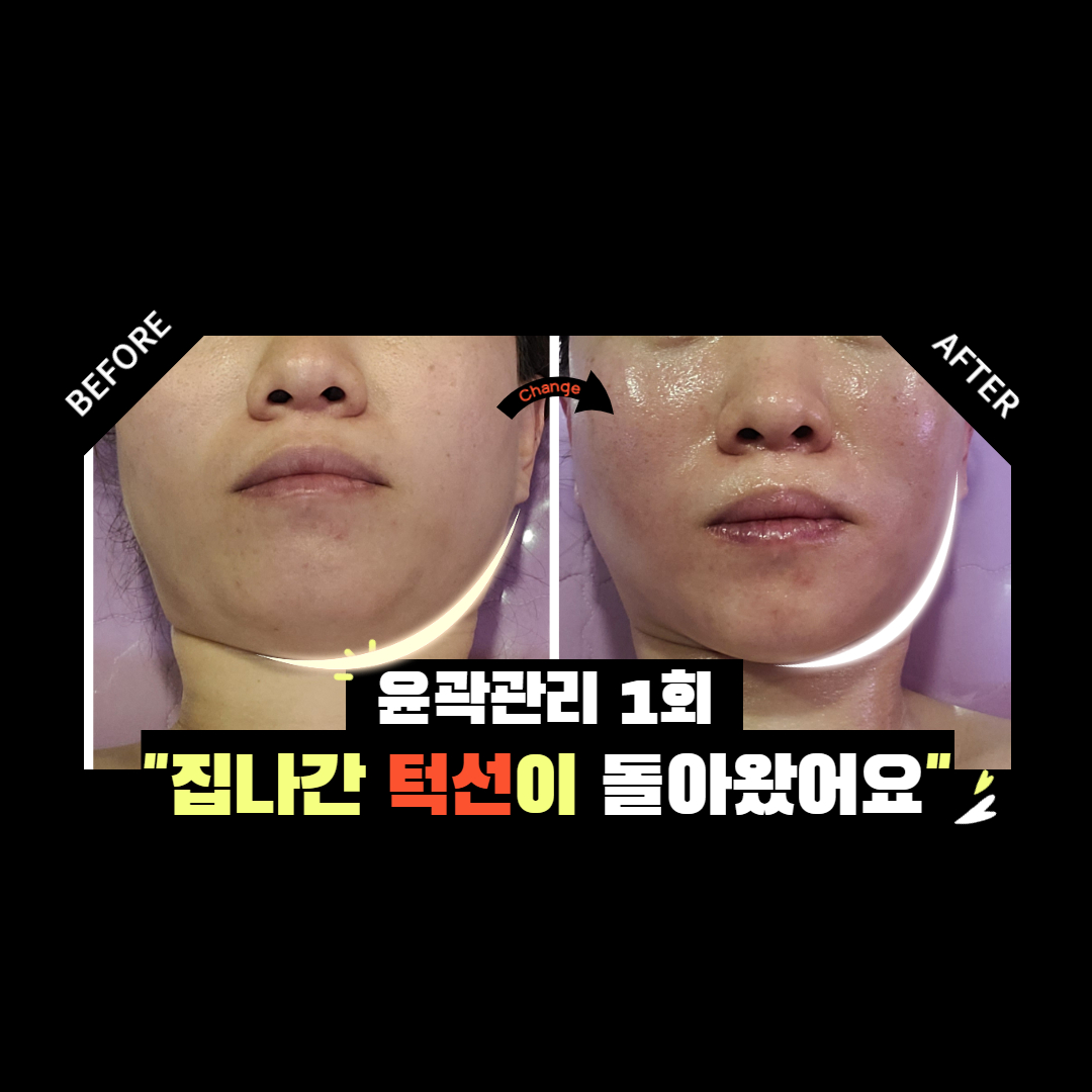 김포피부관리 써마지리프팅 얼굴축소 미백 올케어관리 김민희스파유르 : 김포피부관리 김민희스파유르