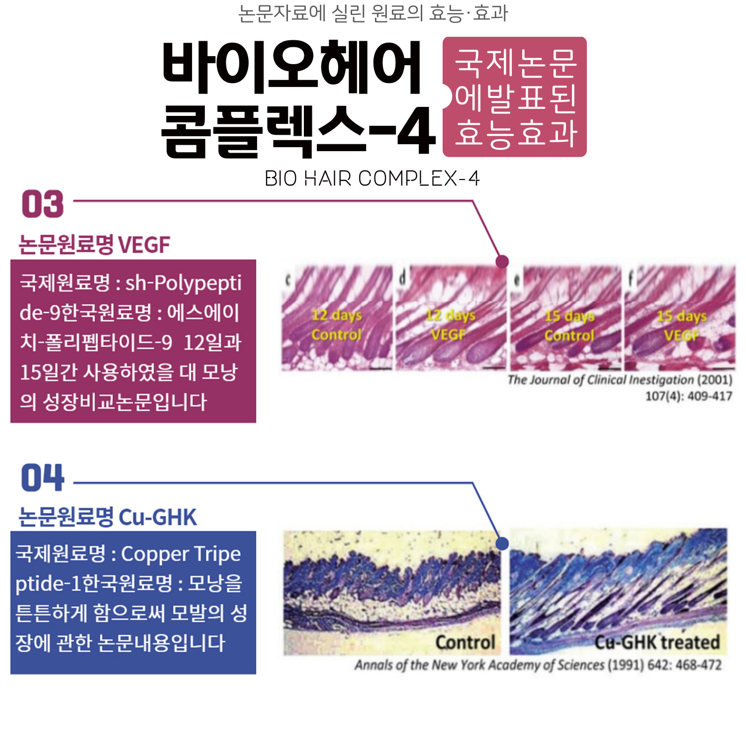 앰플 여성 탈모 에센스 영양제 토닉 두피 영양 진정 바로티나 헤어볼륨에스 : 바로티나