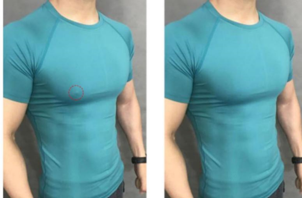 남자니플패치 니플밴드 가슴패치 꼭지 유두 가리개 10P : 정감상회