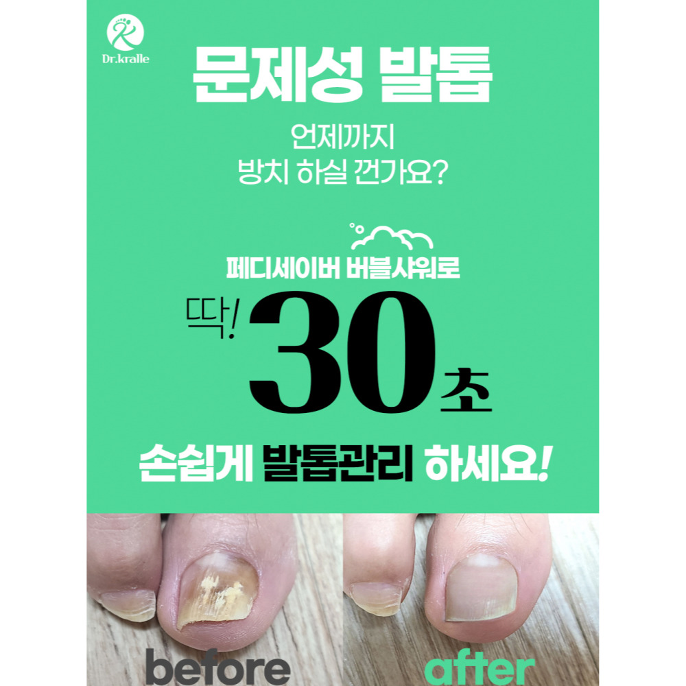 발케어 전문브랜드 닥터크랄레 페디세이버 15ml 문제성발톱 케어 발건강 홈케어 : 언제나맑음  스토어