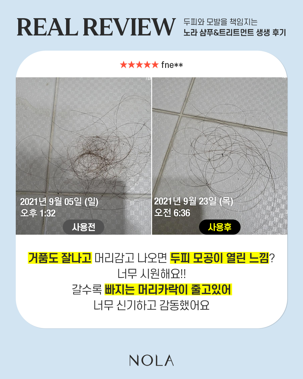 노라 비듬 탈모샴푸 & 헤어트리트먼트 세트 : Yoonbling