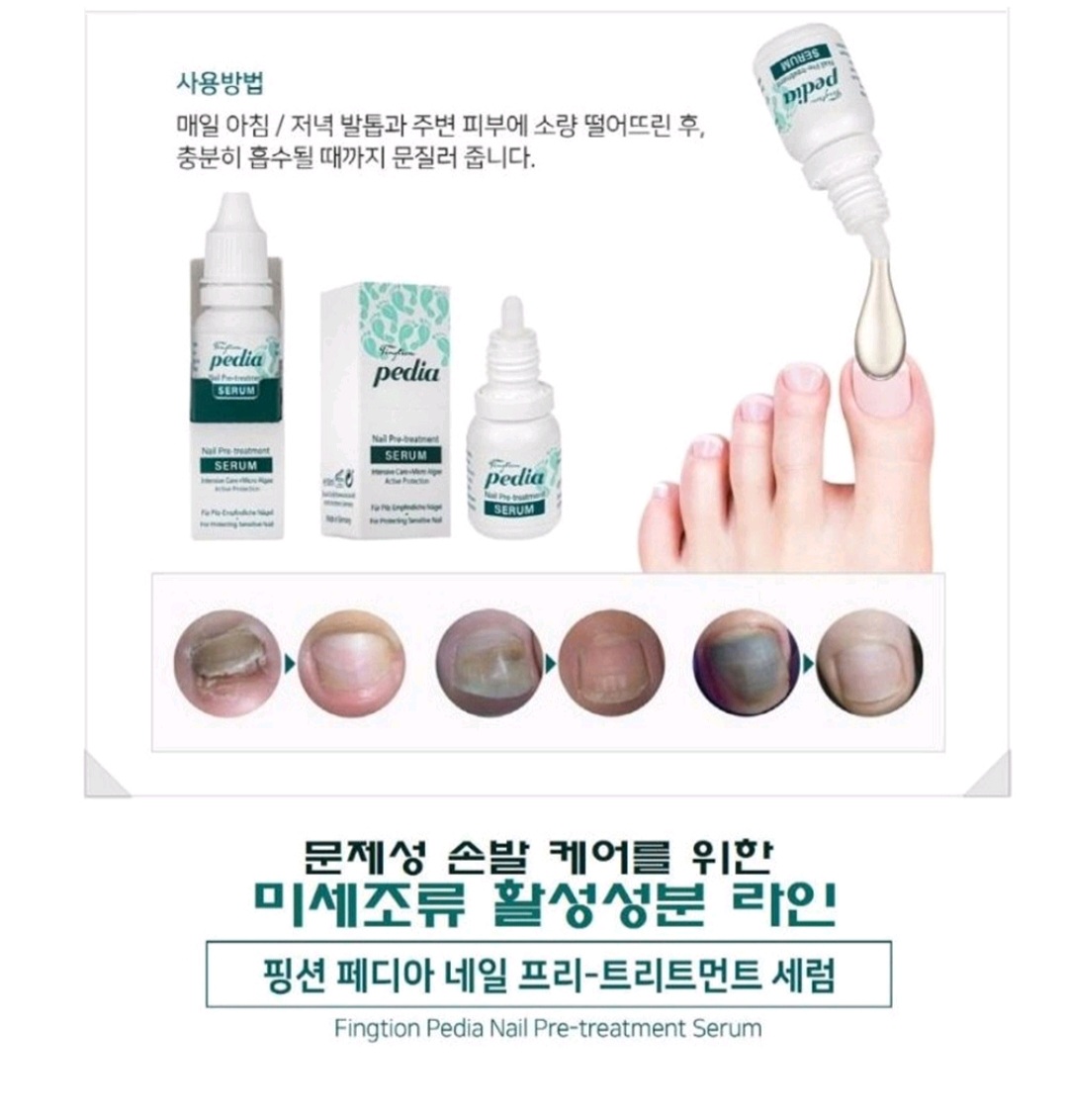 핑션 페디아 풋 프리 트리트먼트세럼 +화일증정 문제성 손발톱 개선제 10ml(독일정품) : 네일할인마트
