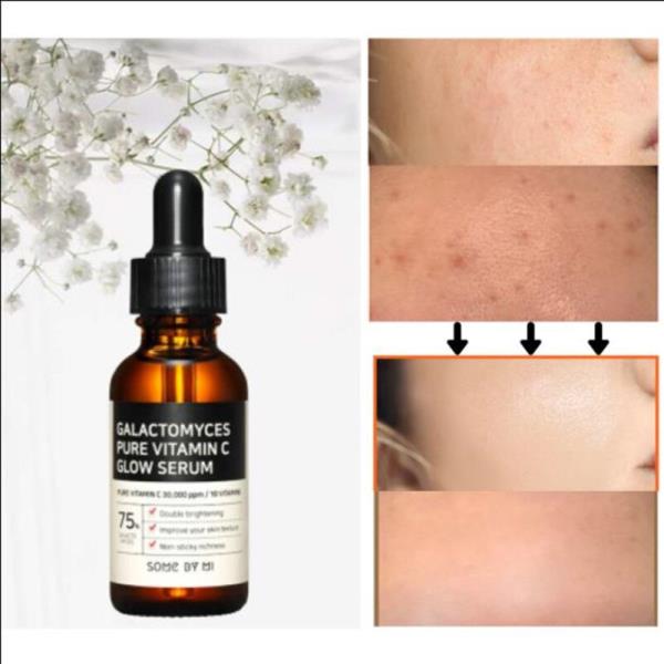 SOME BY MI Galactomyces 퓨어 비타 미 n C 글로우 세럼 30g 화이트닝 페이스 에센스 다크 스팟 리무버 모이스처라이징 스무딩 : hansol.co