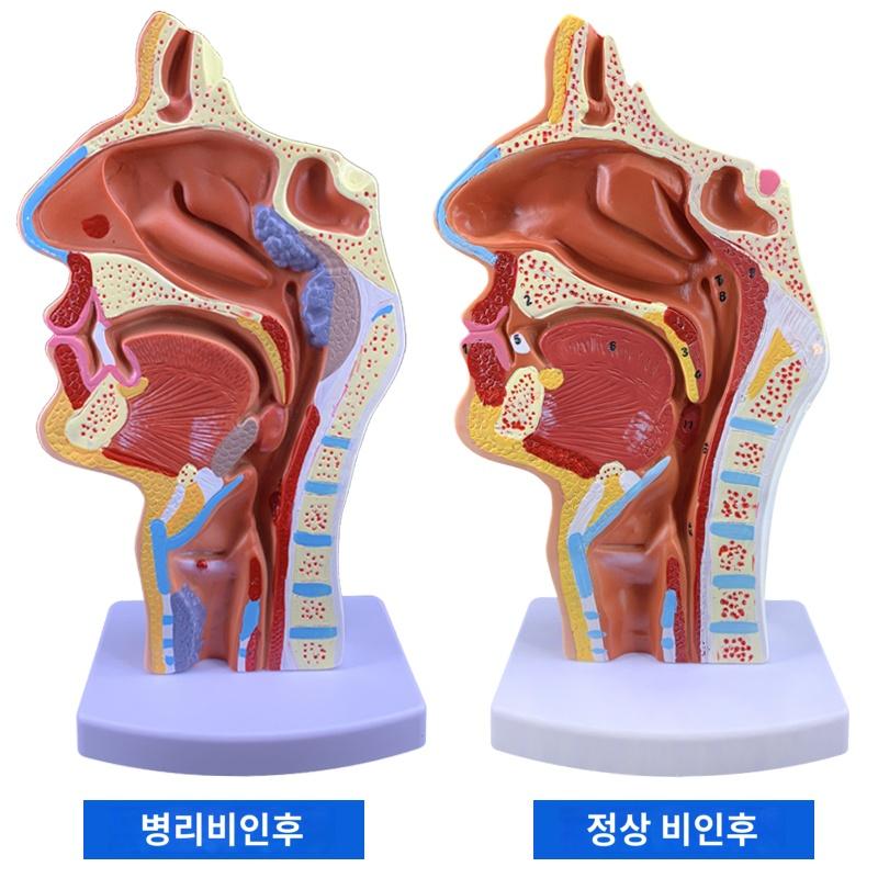 인체모형 해부학 사람모형  인간 비강 해부학 모델 코 모델 ENT 모델 병변 비강 코 목구멍 코 구조 : MoccaStore