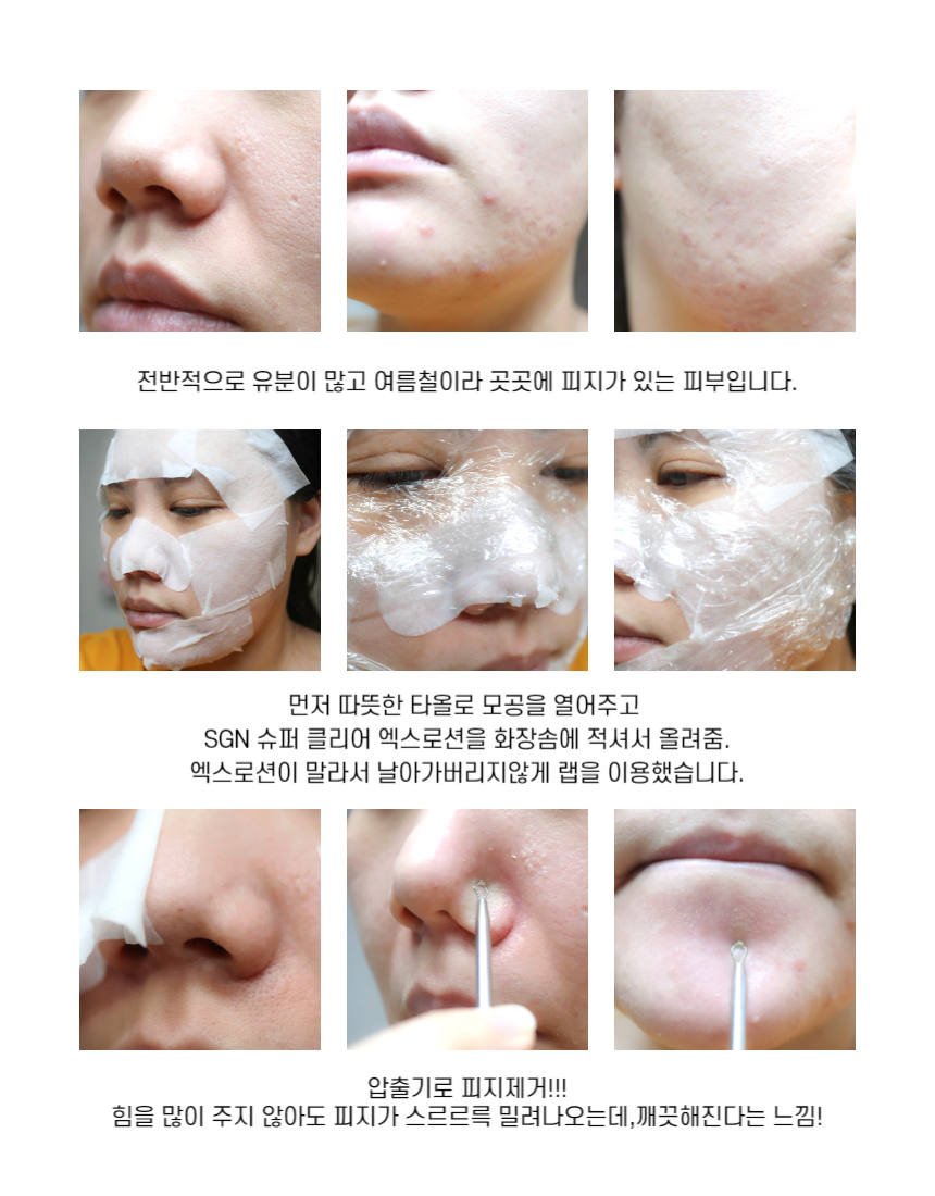 [에스지엔바이오]저자극성 피지연화제 Dr.SGN 슈퍼클리어엑스로션 300ml 얼굴 피지제거 코블랙헤드없애는법 : 원스뷰티몰