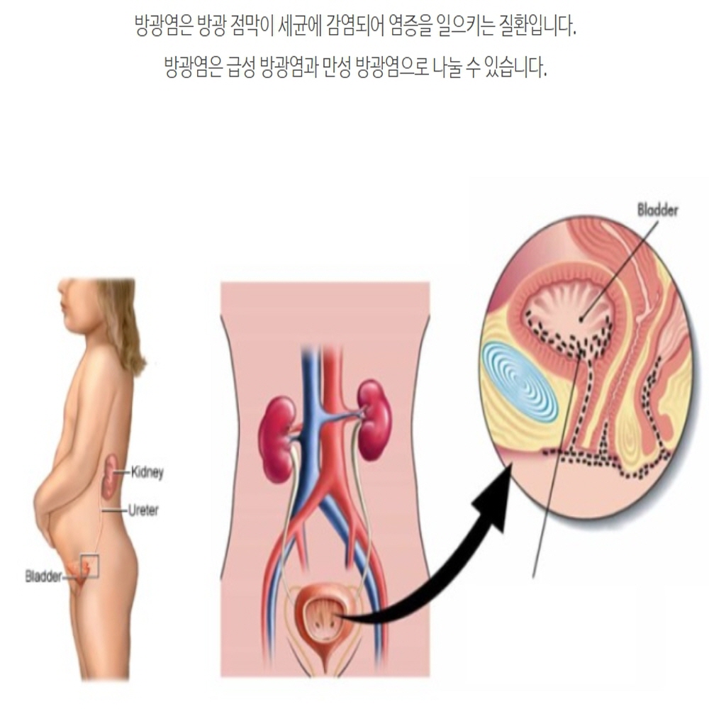 호장근 쏘피야 : 샤론스톤지샾