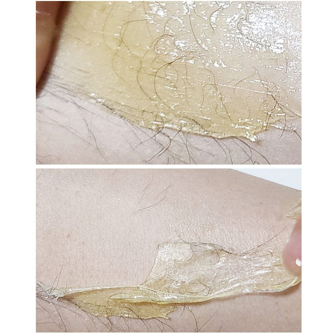 국내산 메디스폰 네이쳐 티트리 슈가링 하드-브라질리언 셀프왁싱 겨드랑이 제모 슈가왁스 : 플러스알렙