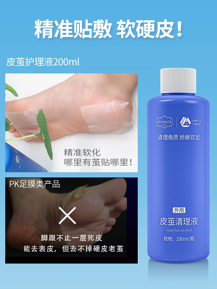 리미지 발뒷꿈치굳은살 죽은 피부 각질 노가죽 뒷꿈치 발바닥 발톱손질 스크럽 풋 발껍질 비신기 백태제거 : 삼거리마트