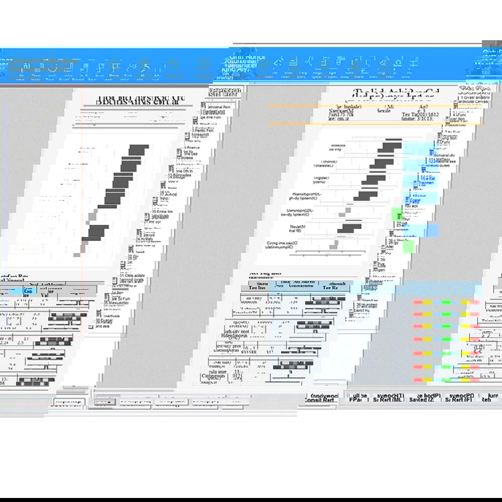 QMR-998 양자 공명 자기 분석기 세트, 핸드 터치 양자 신체 분석기, 하위 건강 테스트용 52 개 보고서, 10 번째, 신제품 : 모두클럽스토어