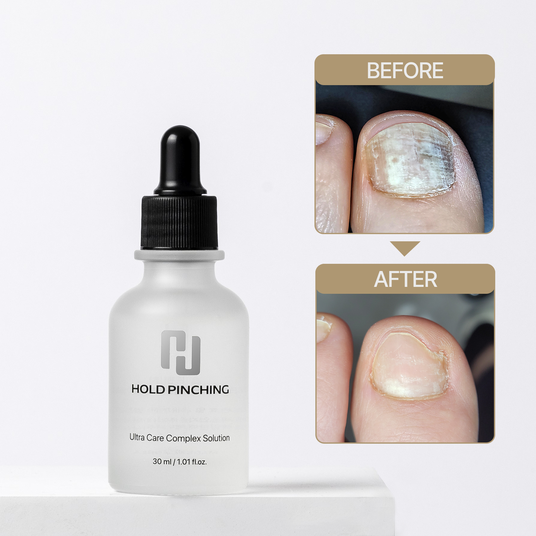 홀드핀칭 문제성발톱 솔루션 풋케어 손발톱 앰플 30ml 발톱강화 : 엔젤스 리퀴드