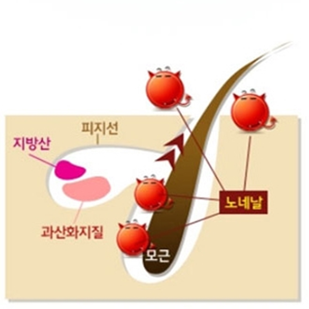 노네날 노인냄새제거 체취바디워시 노인냄새 : 푸른숲상점