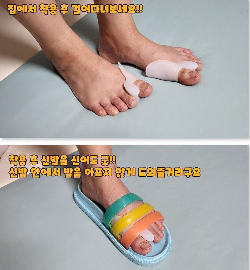 발가락 교정기 (좌우한쌍) 보호대 실리콘 엄지 링 벌리기 밴드 휨 소건막류 무지외반증 i : 에너지쇼핑