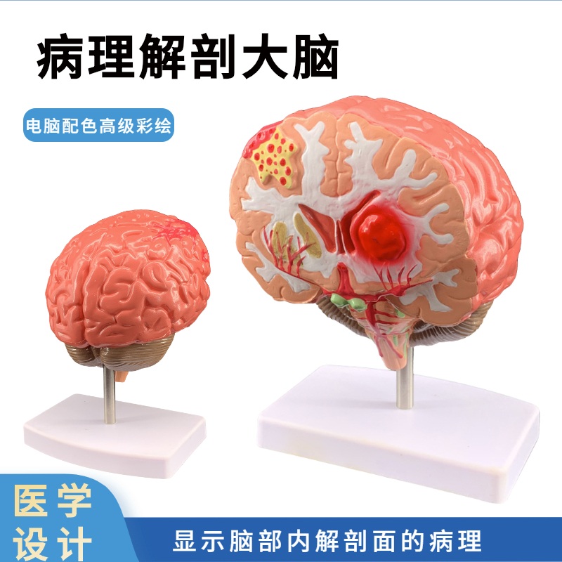 뇌 모형 두개골 해부학 모델 인체 두뇌 실습 실험 분해  해부학 뇌 모델 : 위클리핀