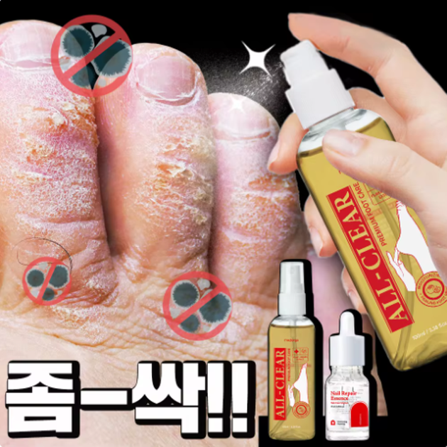메디올가 문제성 손발톱 집중 완벽케어 2종세트 네일에센스+풋미스트 : 온더하기
