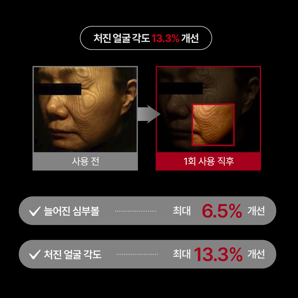 슈마지 골드실 랩핑 마스크 1+1 박스 : 메디테라피