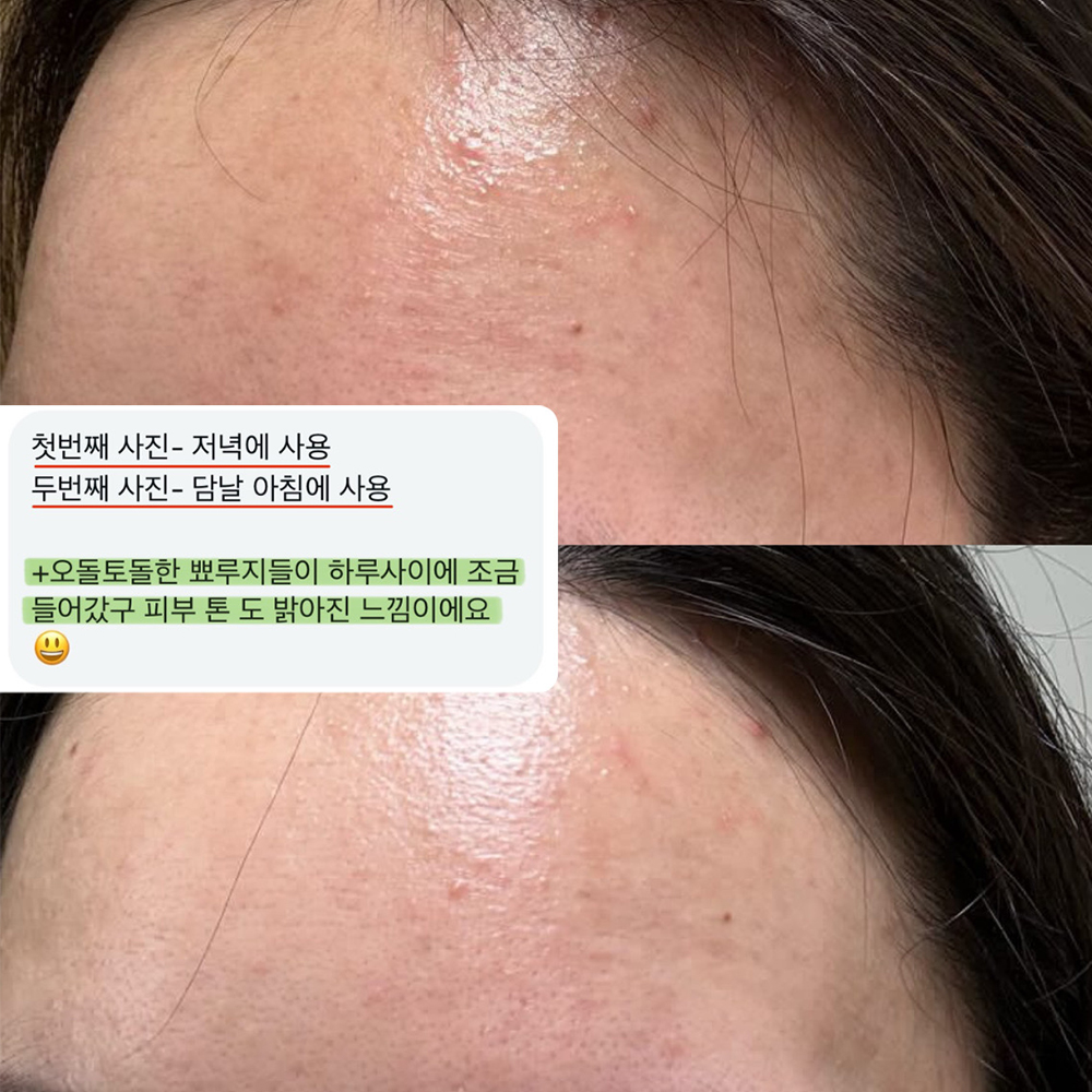 [핫딜] 피부 재건 솔루션 ★더마리본★ 효소클렌저/기초라인 : 셀린 제이