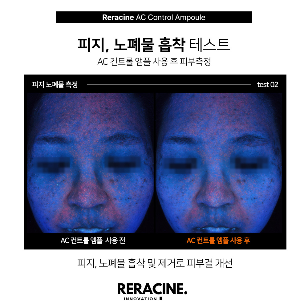리라신 AC아크컨트롤 앰플 30ml 트러블 피지조절 모공 지성 : 고레소레