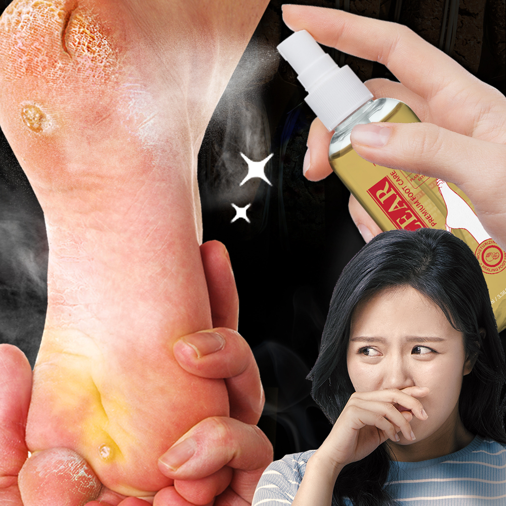 풋 케어 발냄새 발습기 발각질 스프레이 올 클리어 미스트 100ml : 오가닉포에버
