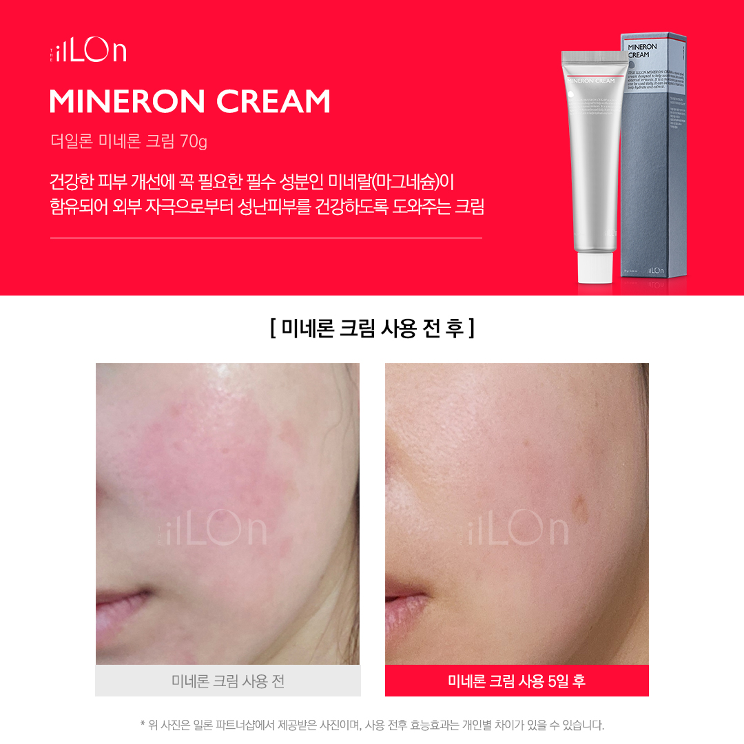 [ILLON]일론 미네론 크림 70g : 디아에스테틱