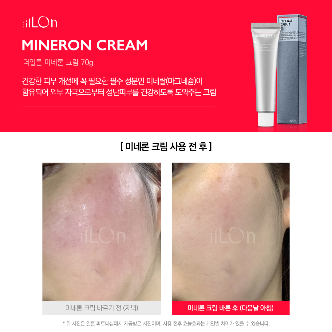 [ILLON]일론 미네론 크림 70g : 디아에스테틱