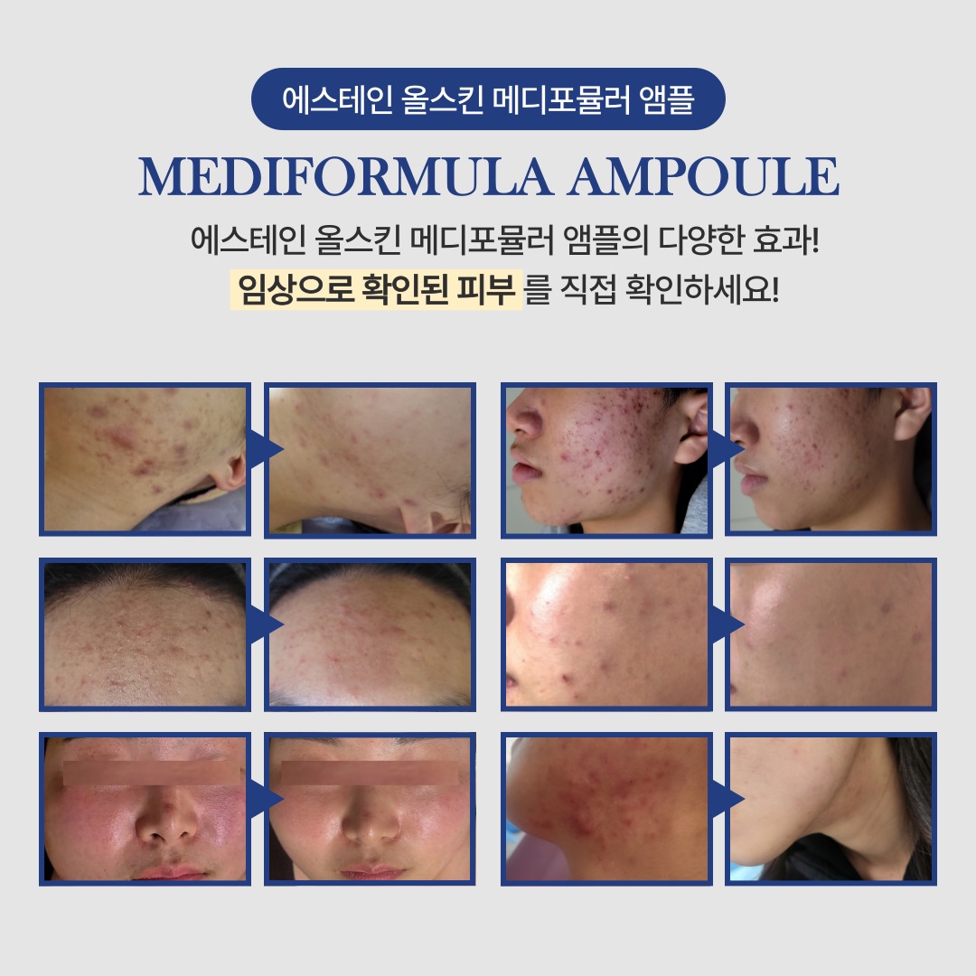 에스테인 메디포뮬러 앰플 50ml : 더웨이장유점