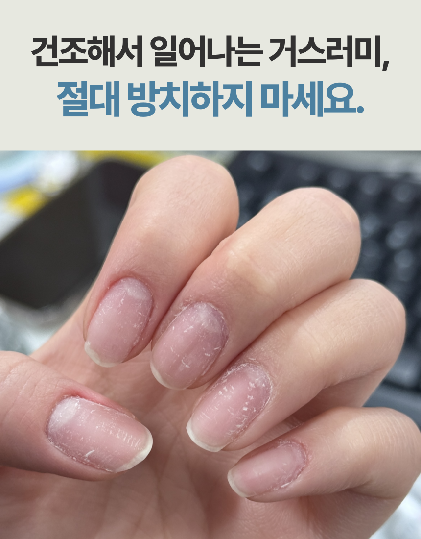젤리핏 아로마 오일밤 큐티클 오일펜 2ml 네일 명품 향 샹스 네롤리 도손 딥머스크 : 아이젤리핏